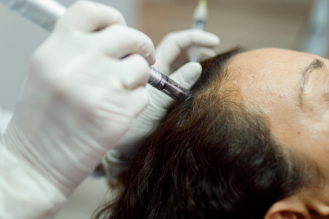 Nature Saúde Capilar é especializada na Terapia Capilar Integrativa, oferecendo protocolos profundos e eficazes, tanto para o público feminino quanto para o masculino. Nossa premissa é um tratamento customizado que atua na raiz dos problemas, promovendo a saúde de forma integral.